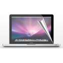 Xssive Screen Protector voor MacBook Pro Retina 15 inch 2014/2015